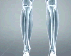 Silicone Toe Separator 2