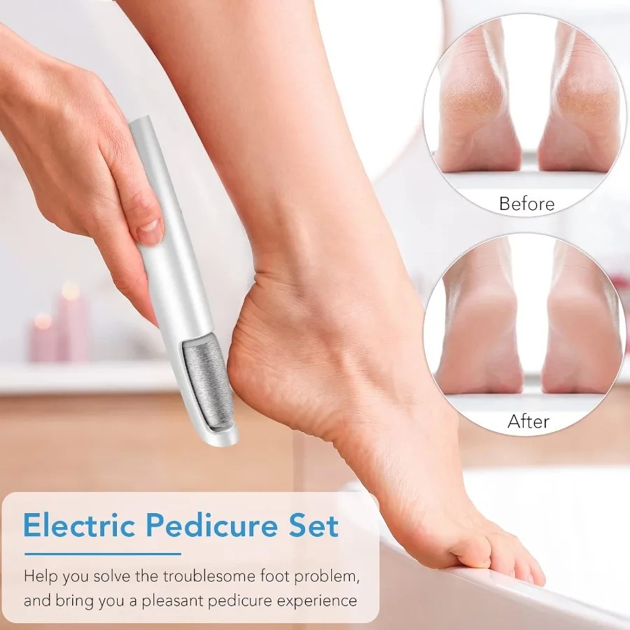 Rechargeable Electric Callus Remover 2