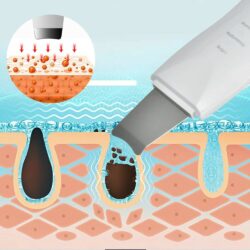 Ultrasonic Skin Scrubber Deep Cleaning 3
